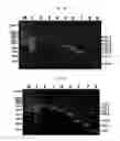 Fig. 06 - Primers and kits for colony multiplex PCR for the detection of class A, B, C, and D beta-lactamase genes and methods of using thereof
