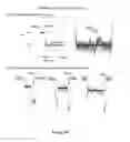 Fig. 71 - Methods and Compositions for Target Detection in a Nanopore Using a Labelled Polymer Scaffold