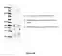Fig. 80 - Methods and Compositions for Target Detection in a Nanopore Using a Labelled Polymer Scaffold