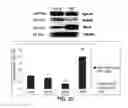 Fig. 08 - Method for determining decrease in functions of hippocampus by using correlation between micro RNA and NMDA receptor, method for inhibiting decrease in functions, and method for screening for inhibitors of decrease in functions