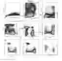 Fig. 02 - METHOD FOR EVALUATING INDIVIDUAL RADIOSENSITIVITY AND THE RISK OF ADVERSE EFFECTS