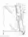 Fig. 06 - Actuatable sliding panel assembly; retrofit kit and method for retrofitting a sliding panel for mechanically assisted movement between open and closed positions