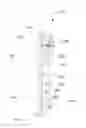 Fig. 01 - ADJUSTABLE LADDER DEVICE AND METHOD