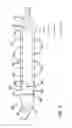 Fig. 03 - Steerable mole boring system