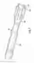 Fig. 08 - PLUG SECUREMENT AND RUNNING ARRANGEMENT AND METHOD
