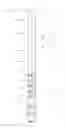 Fig. 03 - Downhole apparatus for disconnecting portions of downhole tool string