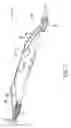 Fig. 08 - Sensor deployment system and method using a movable arm with a telescoping section
