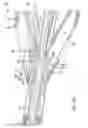 Fig. 11 - Sensor deployment system and method using a movable arm with a telescoping section