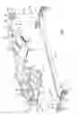 Fig. 02 - Reconfigurable surgical frame and method for use thereof