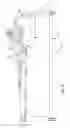 Fig. 09 - Reconfigurable surgical frame and method for use thereof