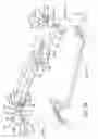 Fig. 71 - Reconfigurable surgical frame and method for use thereof