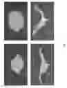 Fig. 09 - SYSTEMS AND METHODS FOR ACTUATING SOFT ROBOTIC ACTUATORS