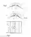 Fig. 02 - Foil bearing