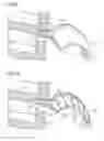 Fig. 06 - COMBUSTOR FOR A GAS TURBINE