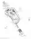 Fig. 02 - Priming valve to induce appropriate pressure and flow profile and improve sensor readiness