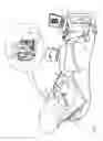 Fig. 02 - Global mapping catheter contact optimization