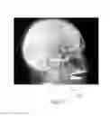 Fig. 07 - Image processing system for eliminating or reducing streak artifacts in rotational imaging