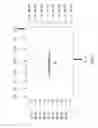 Fig. 08 - Mesh-based digital microbeamforming for ultrasound applications