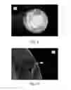 Fig. 07 - COMPOSITE WIRE