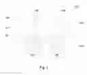 Fig. 02 - Trench capacitor and method of forming the same