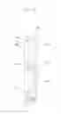 Fig. 04 - Base station including antenna having two-way tilting structure