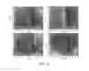 Fig. 19 - Foreign Object Detection In Wireless Energy Transfer Systems