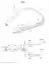 Fig. 05 - Wearable device
