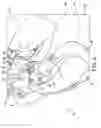 Fig. 06 - Discharge guard assembly for a mower