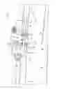 Fig. 07 - Draper Head with Multipart Screw Conveyor