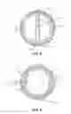 Fig. 06 - Chumming device