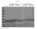 Fig. 04 - METHOD FOR CONCENTRATING PROTEIN IN GRAIN POWDER