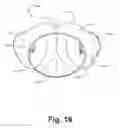 Fig. 27 - DETACHABLE LOWER BODY UNDERGARMENT