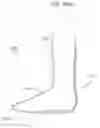 Fig. 10 - Sock with support assemblage