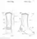 Fig. 11 - Sock with support assemblage