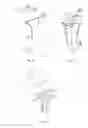 Fig. 06 - SHOE SET WITH SHOE BASE AND HEEL