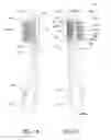 Fig. 12 - Oral care implement