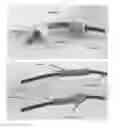 Fig. 01 - Endoscopic devices and methods using same