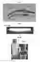 Fig. 06 - Endoscopic devices and methods using same