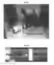 Fig. 07 - Endoscopic devices and methods using same