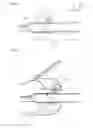 Fig. 03 - Surgical instrument and method for producing a surgical instrument