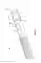 Fig. 02 - BALLOON ATHERECTOMY CATHETERS WITH IMAGING