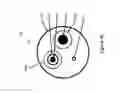 Fig. 11 - BALLOON ATHERECTOMY CATHETERS WITH IMAGING