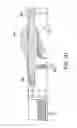 Fig. 12 - BALLOON ATHERECTOMY CATHETERS WITH IMAGING