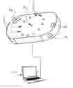 Fig. 01 - Device and method for acquisition of medical images for the analysis of ulcers