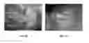 Fig. 03 - Systems and methods for spatial positioning of diagnostic and or treatment probe based on surface profile detection