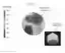 Fig. 04 - SYSTEM OF PREDICTING DEMENTIA AND OPERATING METHOD THEREOF