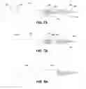 Fig. 07 - Electrode catheter assembly and method for the manufacture thereof