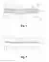 Fig. 02 - METHOD FOR DETERMINING THE INDIVIDUAL BITING FORCE OF A PATIENT