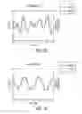 Fig. 04 - Methods and systems for rapid screening of mild traumatic brain injury