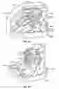 Fig. 30 - Transcutaneous analyte sensors, applicators therefor, and associated methods
